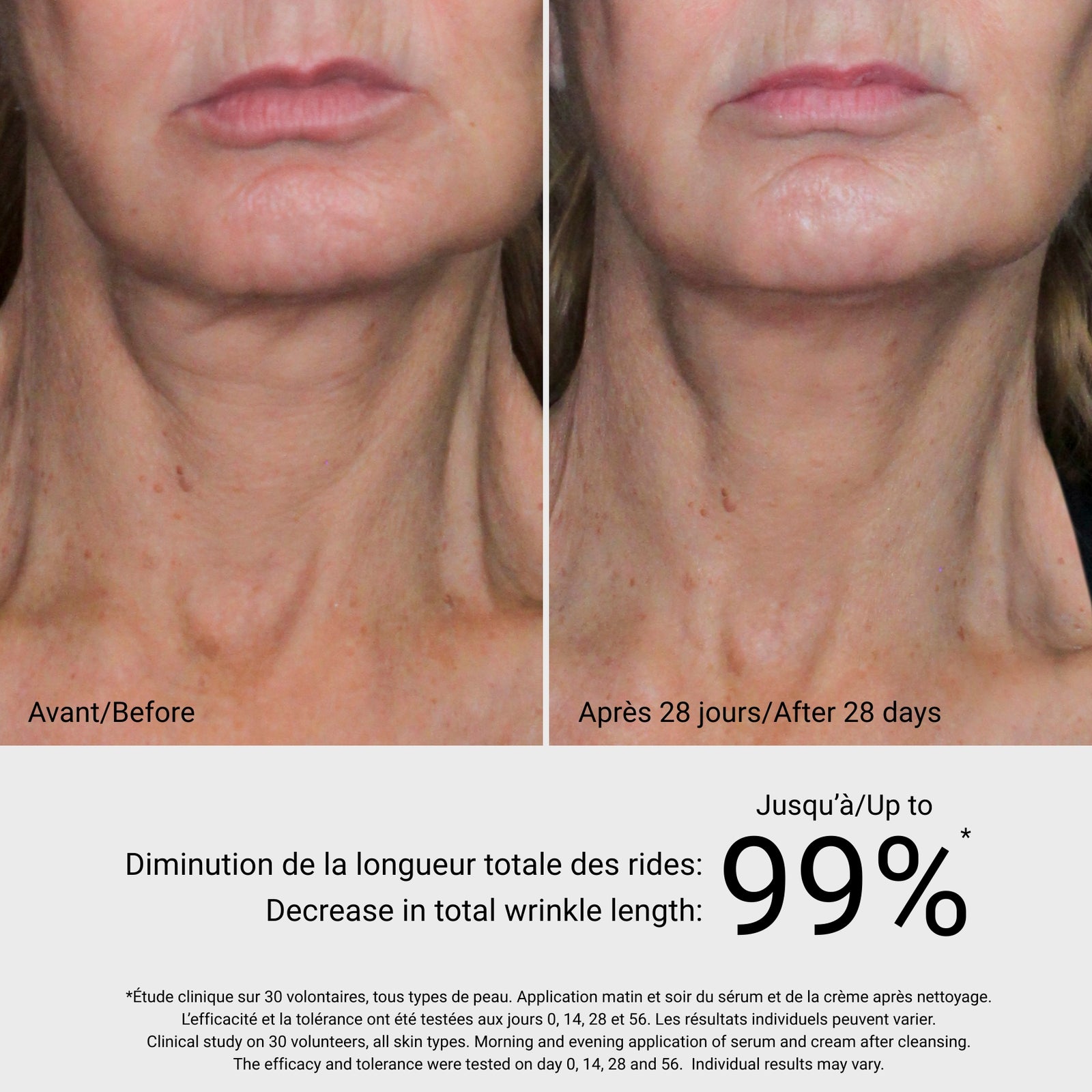 4D Visible Lifting Serum - Improves Skin Tone | GM Collin