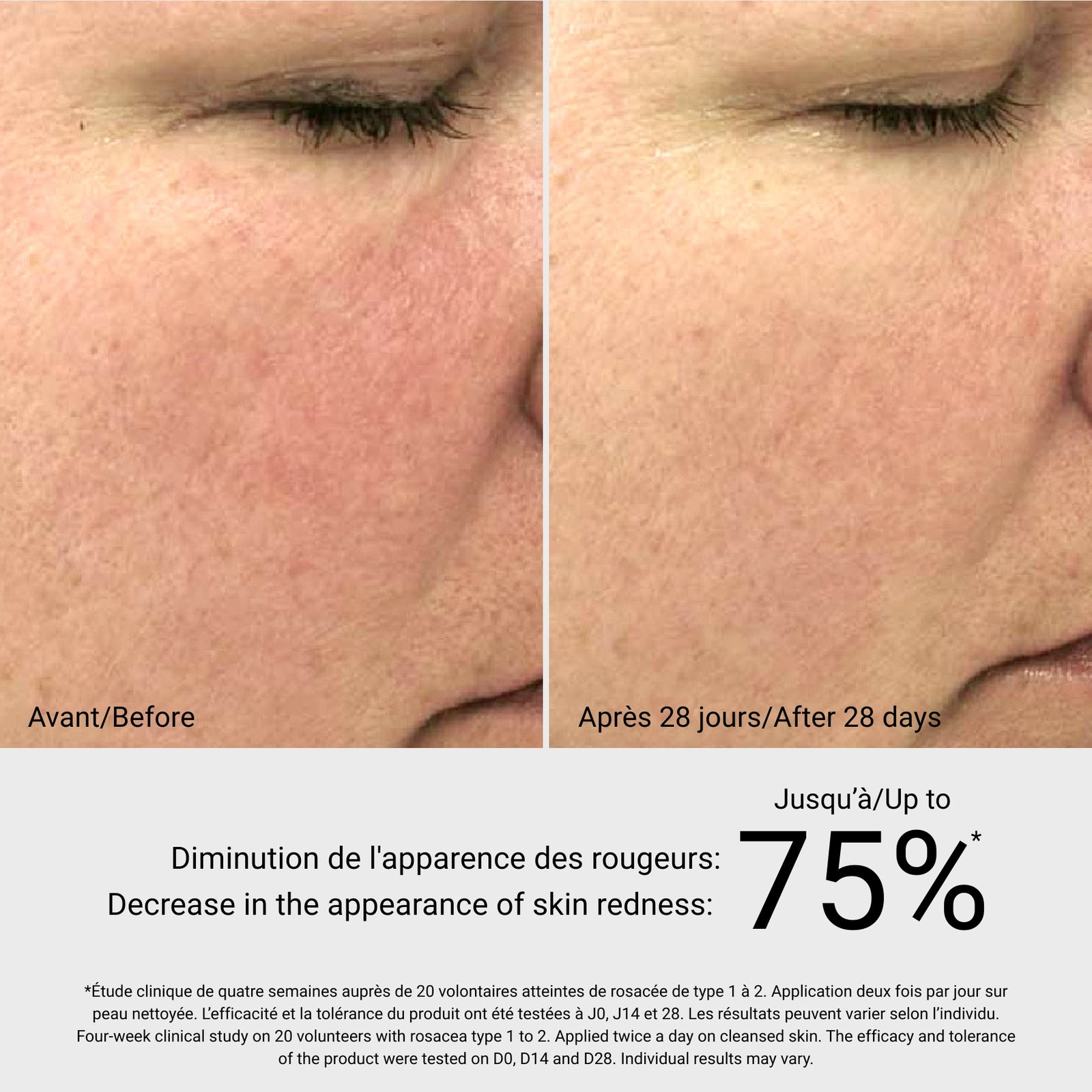 Rosa Sea Gel - Reduces Redness & Discomfort | GM Collin